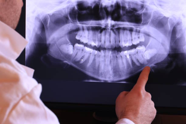 Best Emergency Dental Care for Broken or Chipped Teeth in Slippery Rock, PA