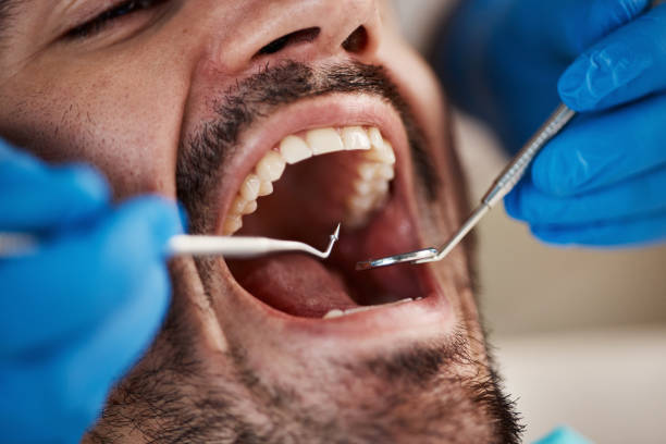 Best Emergency Dental Care for Broken or Chipped Teeth in Slippery Rock, PA