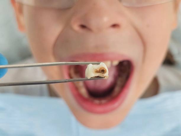 Best Pediatric Emergency Dentist in Slippery Rock, PA
